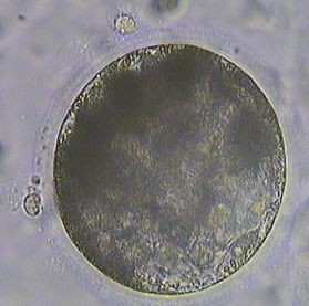 Egg at blastocyst stage